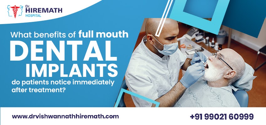 immediate-benefits-after-full-mouth-dental-implants